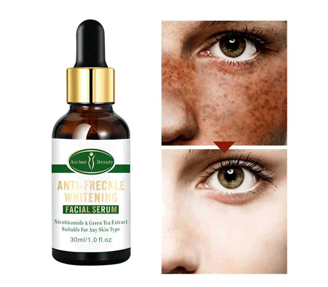 Aichun Beauty Anti Freckle Face Serum 30ml